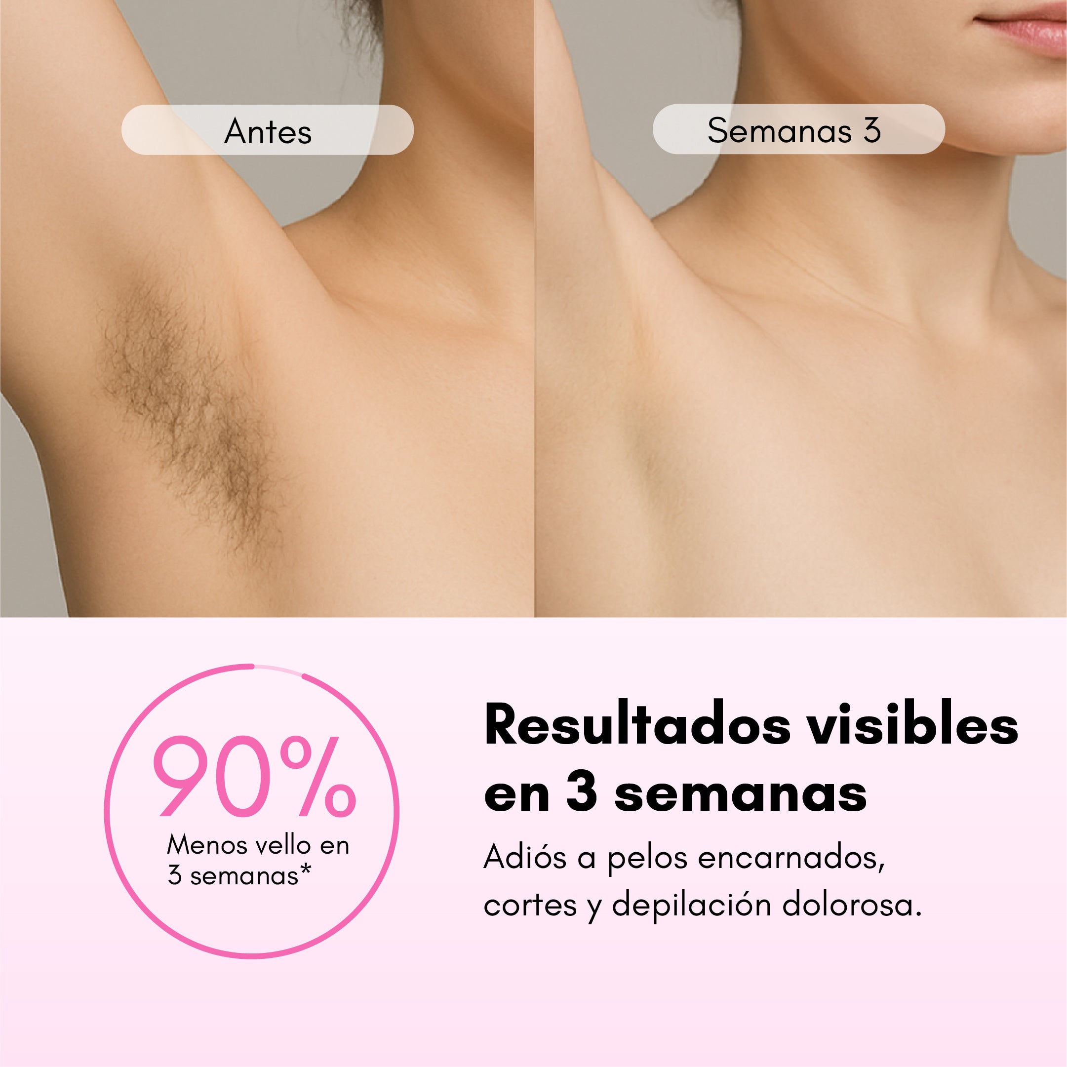 Vellos Encarnados Pelos De Los Brazos Muy Largos Depiladora Láser