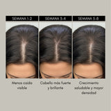 RevitaMAX Estimulador Crecimiento Capilar
