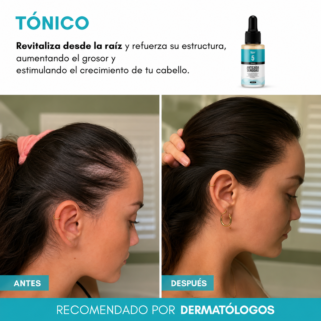 Tónico Anticaída y Densidad (Paso 5) - Rebel